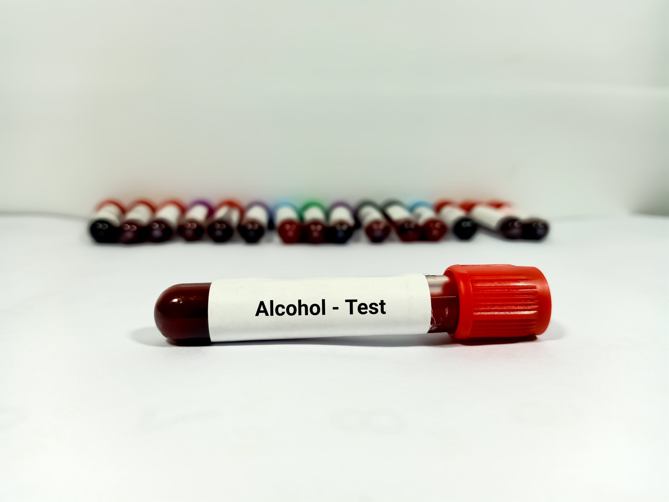 DUI Blood Test